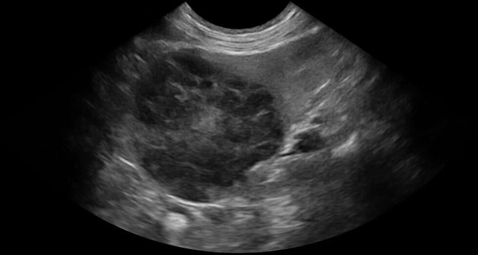 Masse splénique canine – Lymphome