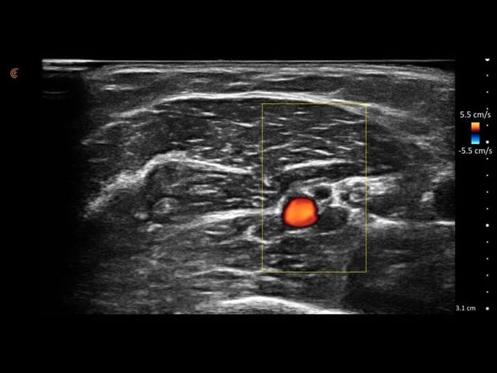 Faisceau neurovasculaire en vue transversale