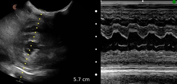 Imagerie cardiaque avec mode M