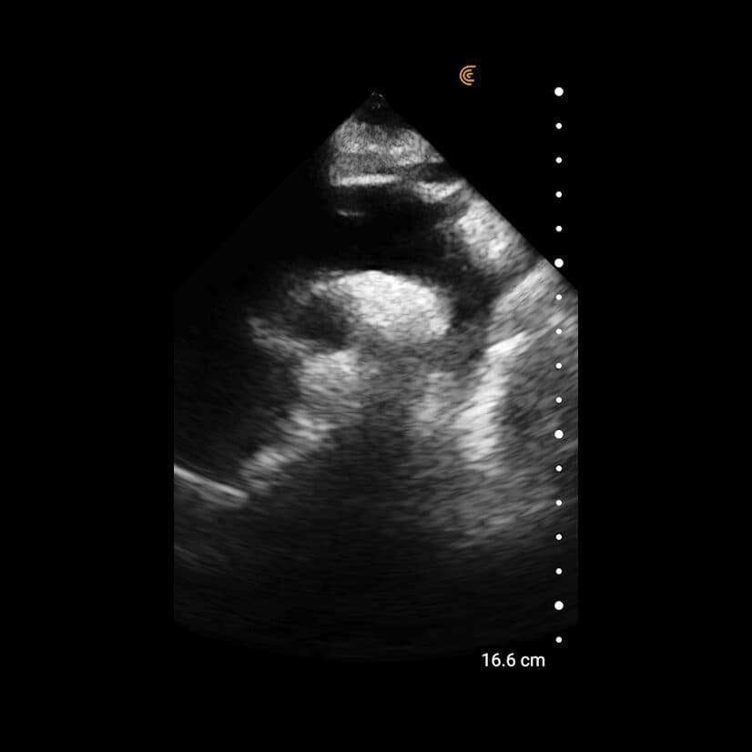 Cardiaque Ciblé