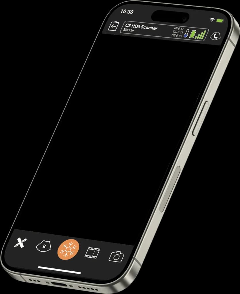 Cadre de téléphone