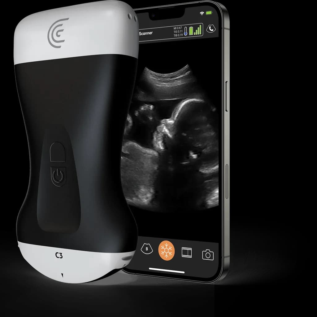 Scanner Clarius C3
