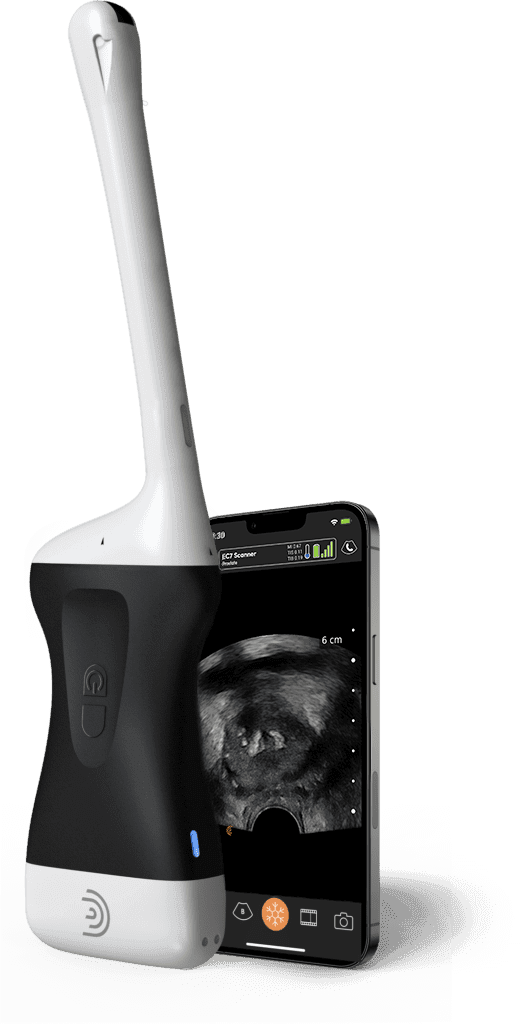 Scanner Clarius EC7
