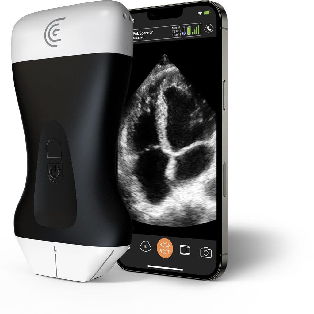 Scanner Clarius PAL
