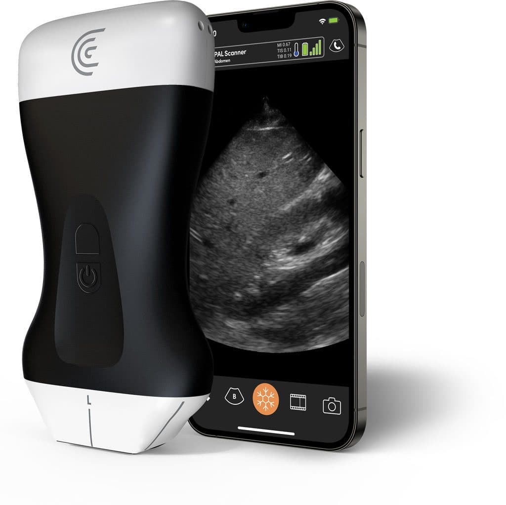 Scanner Clarius PAL pour la médecine interne