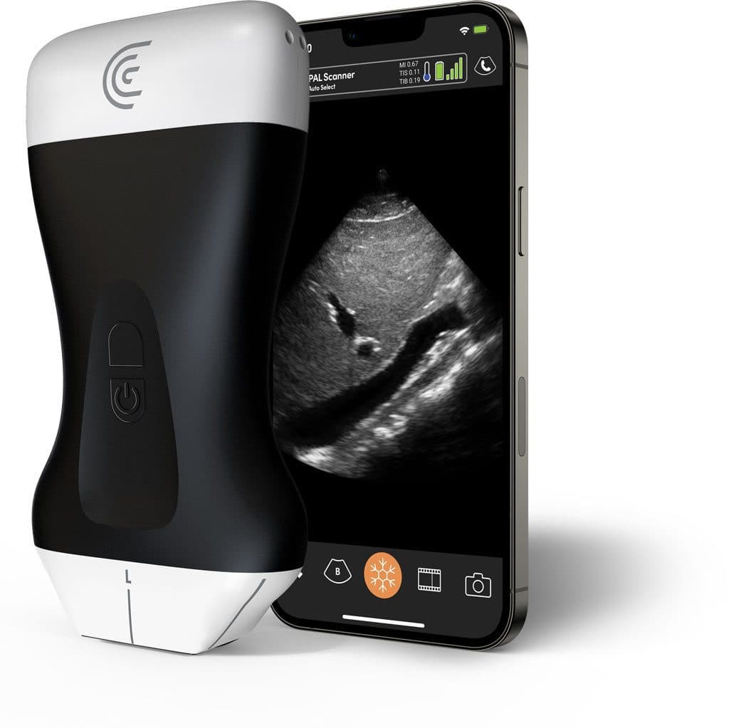 Scanner Clarius PAL