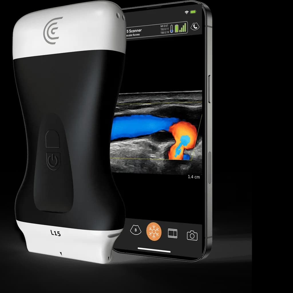 Scanner Clarius pour l'accès vasculaire
