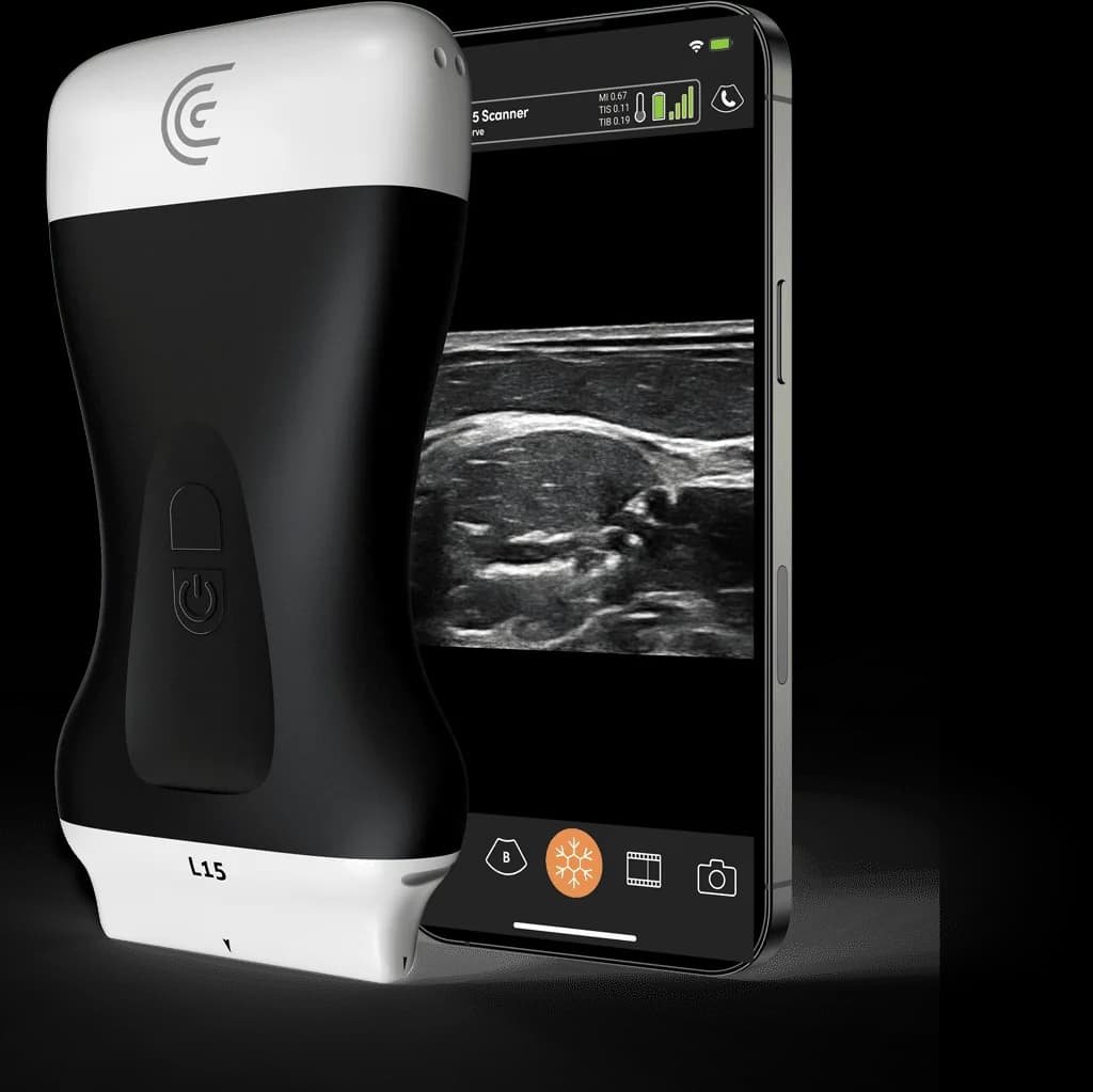 Scanner Clarius L15