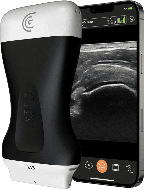 Scanner Clarius L15