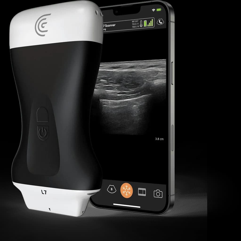 Scanner Clarius L7
