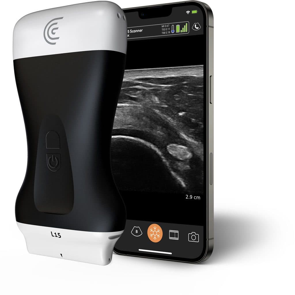 Scanner Clarius pour MSK