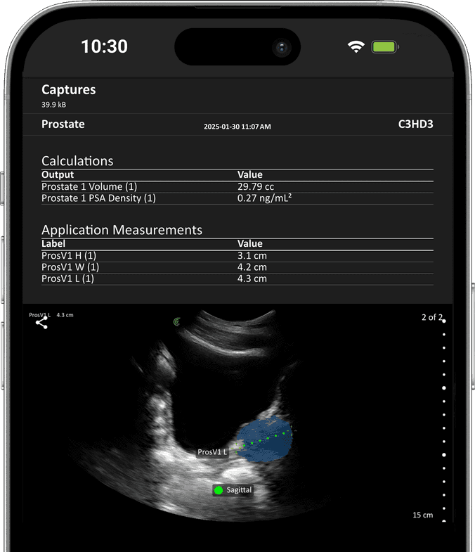 IA Prostate