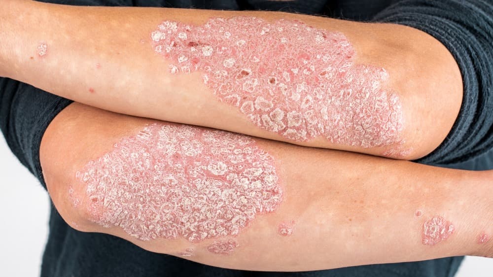 Dermatologie