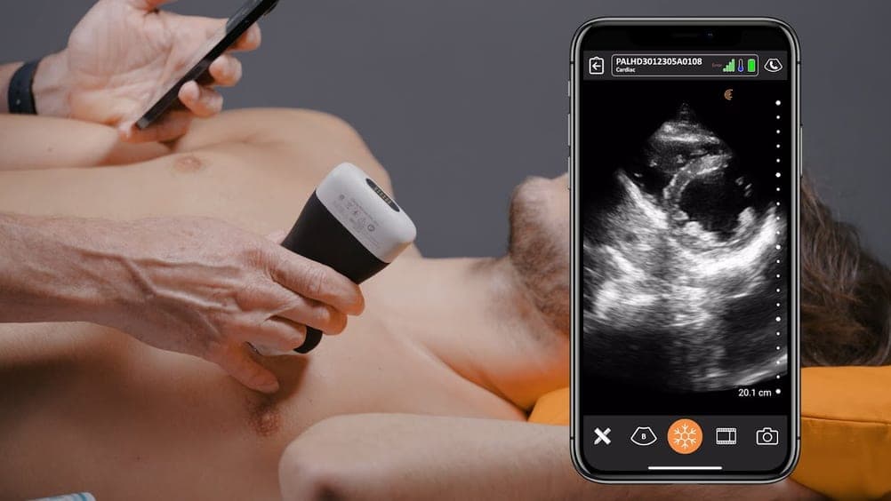 Cardiaque Ciblé