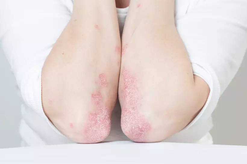 Dermatologie