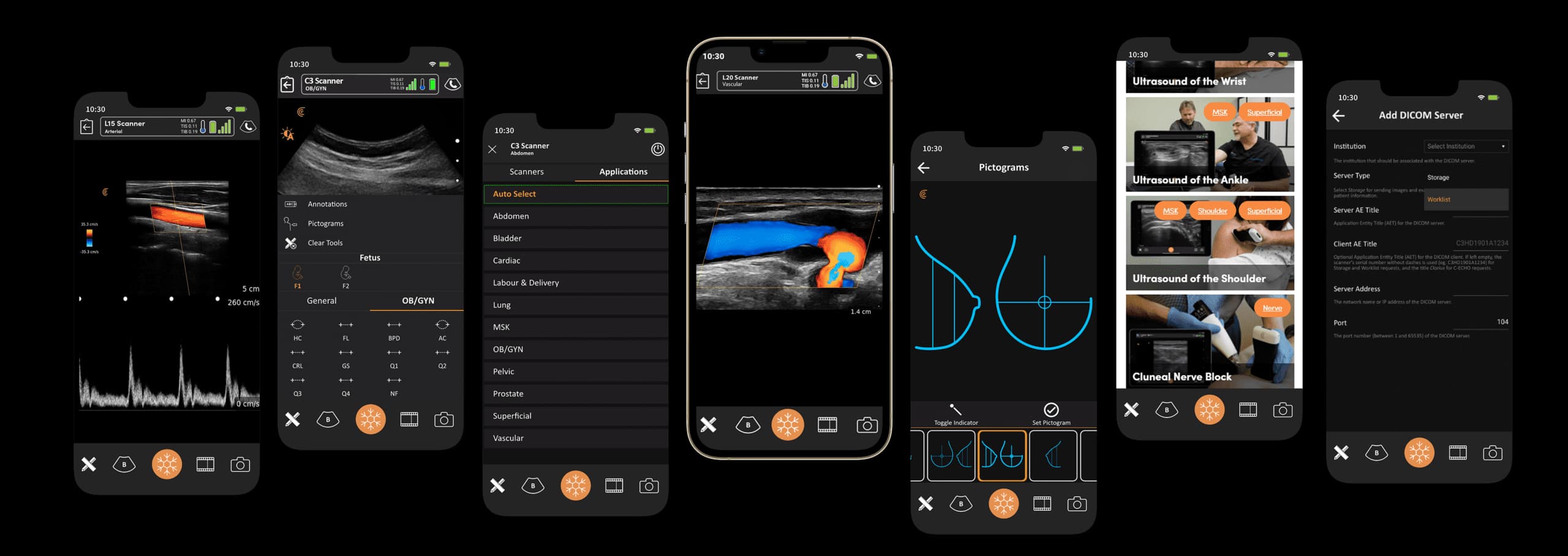 Exemples d’écrans de l’application Clarius, fonctions selon le modèle