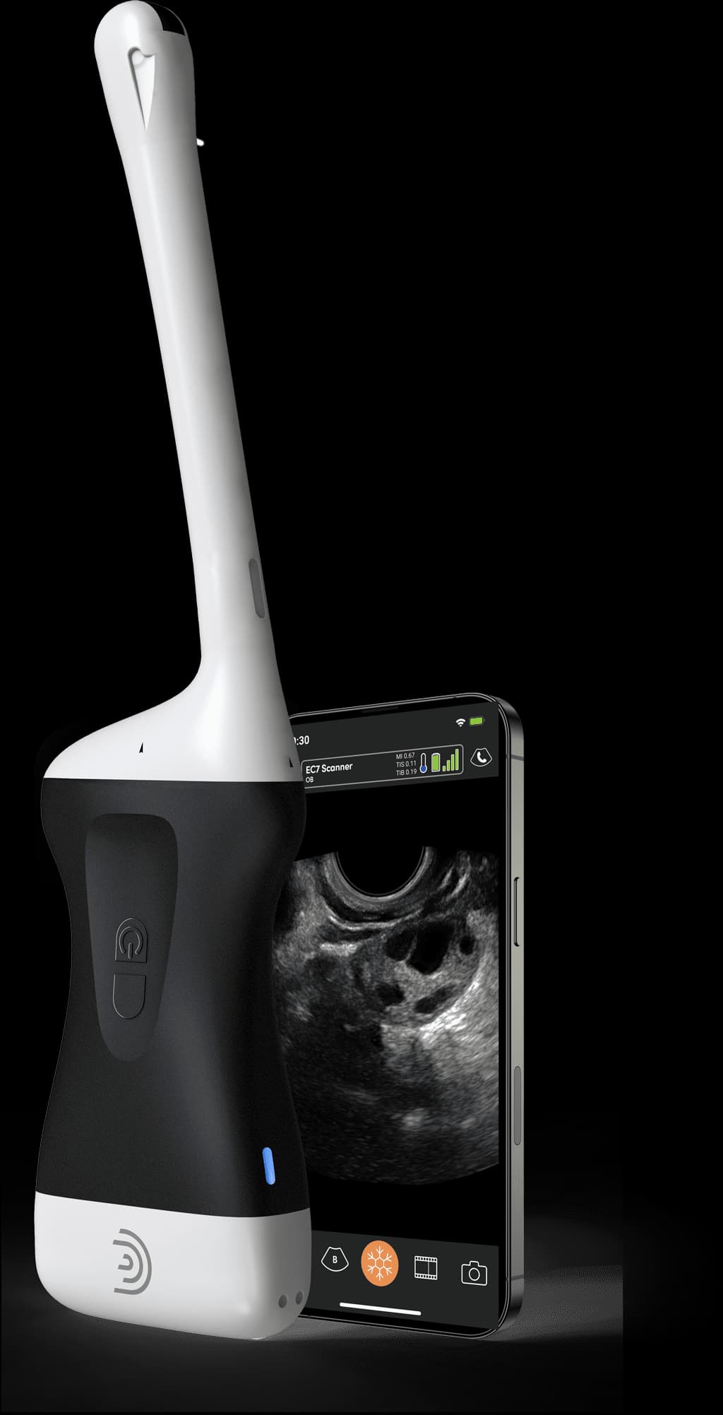 Sonde EC7 HD3 et exemple d’application Clarius