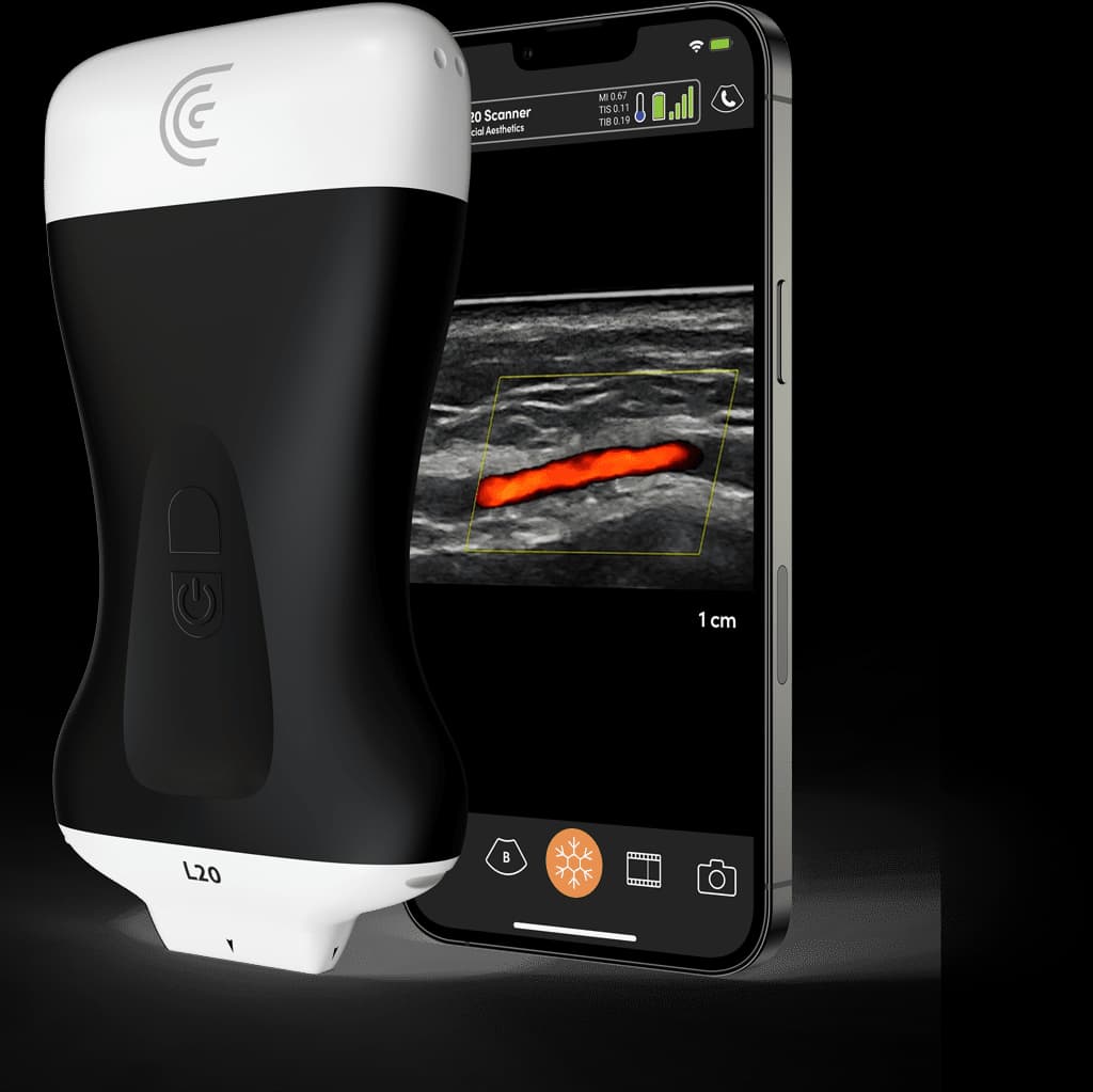 Sonde L20 HD3 et exemple d’application Clarius