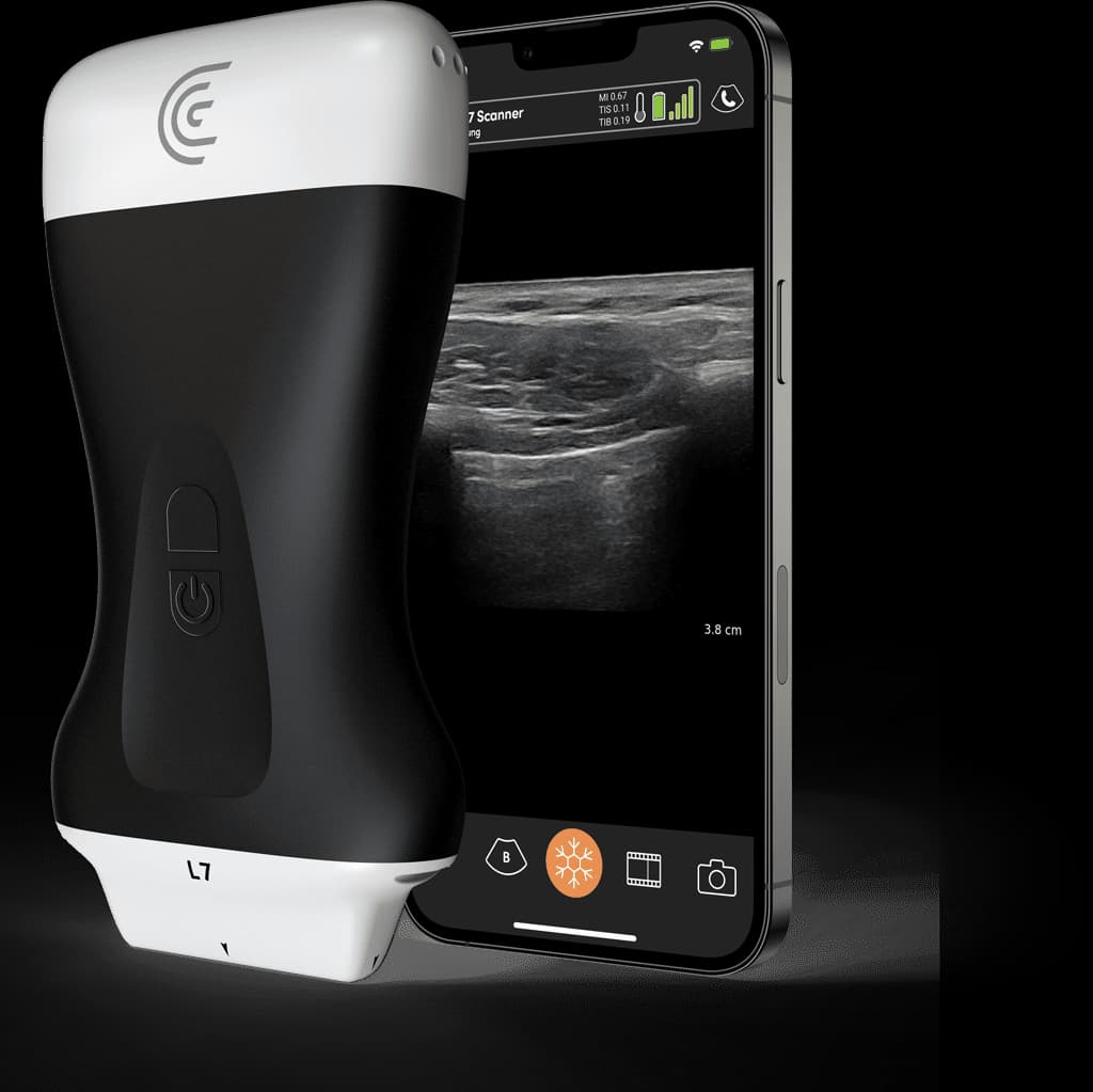Sonde L7 HD3 et exemple d’application Clarius