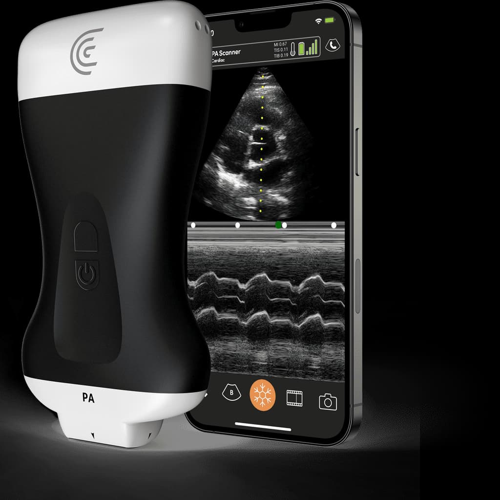 Sonde PA HD3 et exemple d’application Clarius
