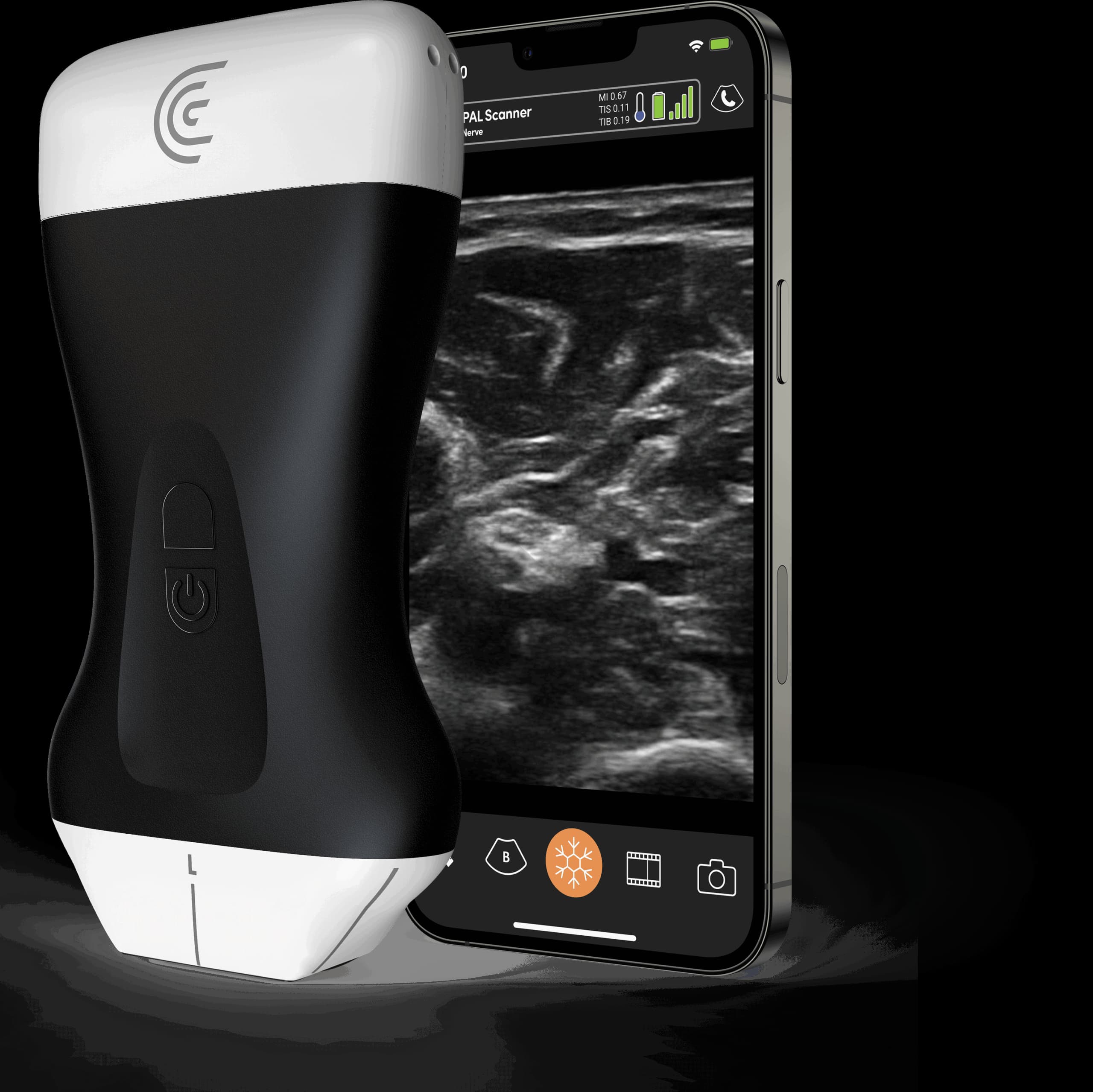 Sonde PAL HD3 et exemple d’application Clarius