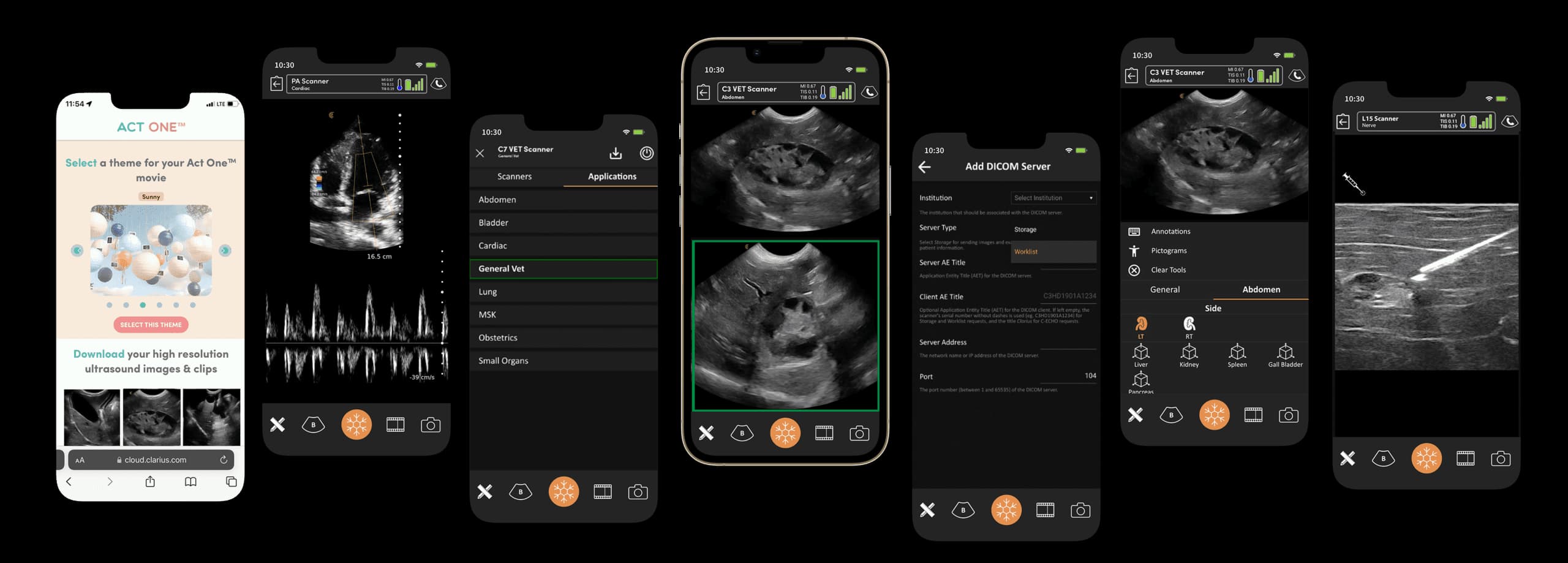 Exemples d’écrans de l’application Clarius, fonctions selon le modèle