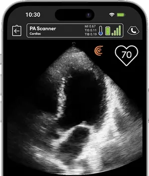 Fréquence cardiaque automatique